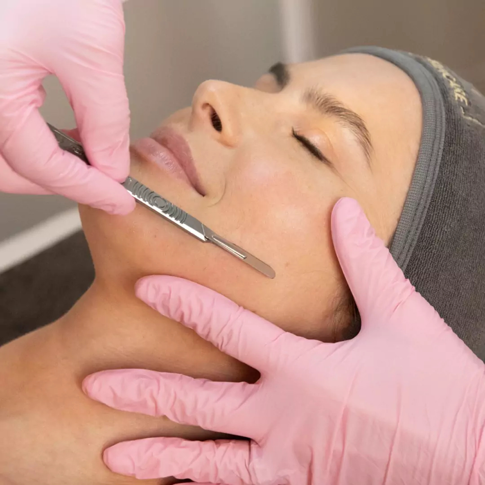 Dermaplaning