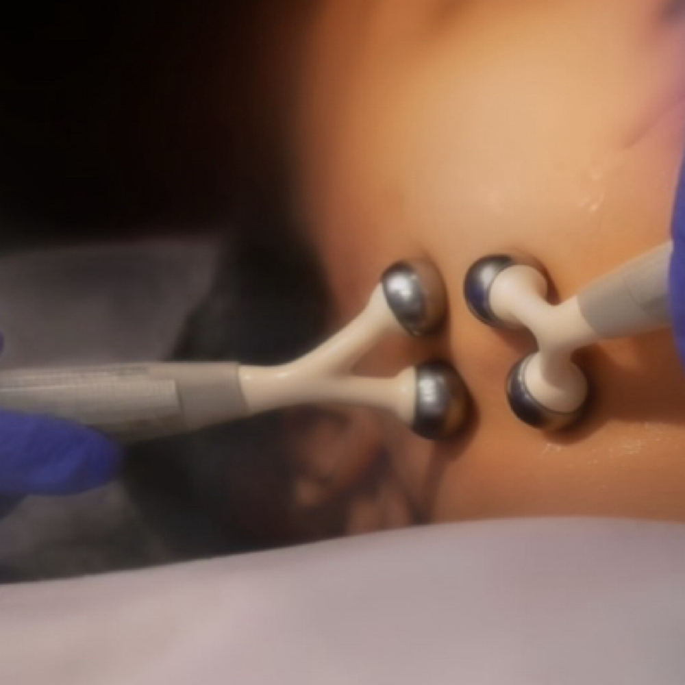 Microcurrent Sculpt Facial at Uncommon Esthetics in Rancho Cucamonga, CA