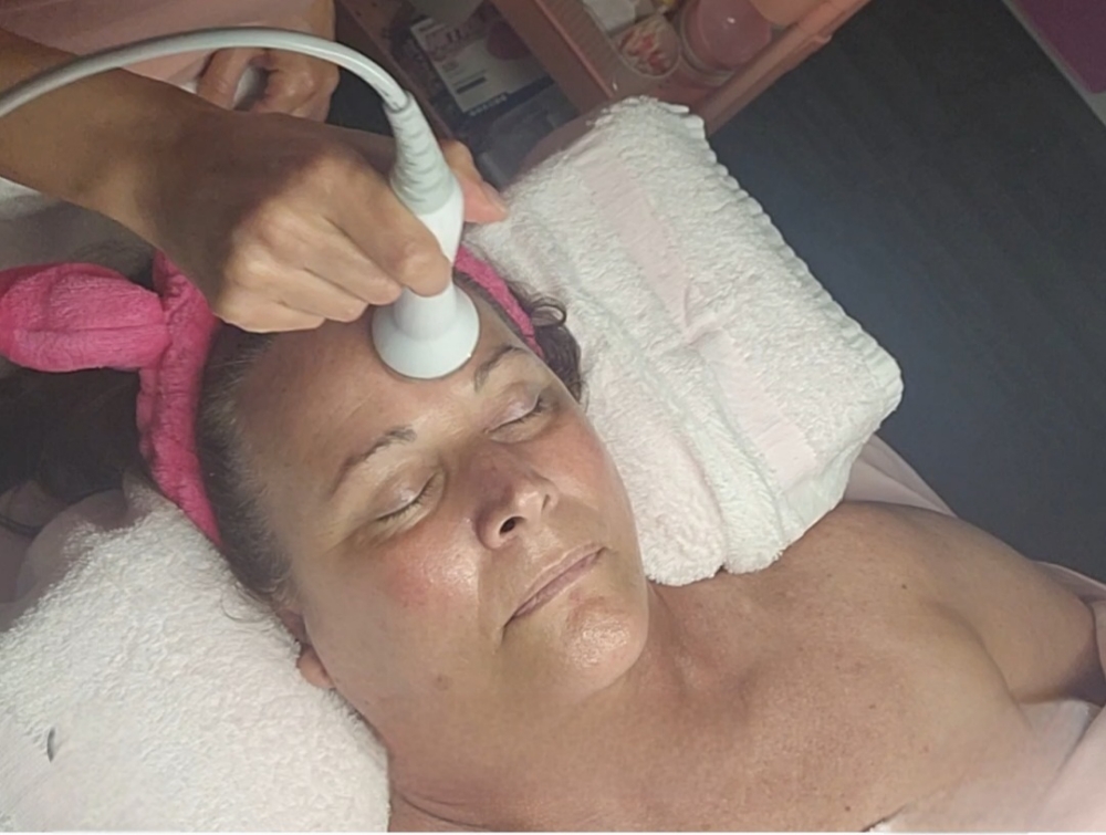 Non-surgical Face Facelift