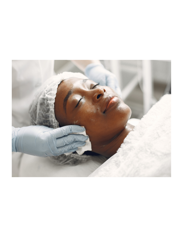 R.A. chemical peel at Anastasia’s Crown in Pittsburgh (Shadyside Area), PA