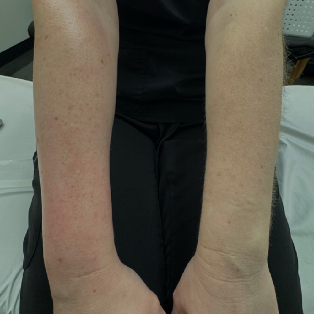 Arm Wax at Skin Haven Co. in Fort Wayne, IN