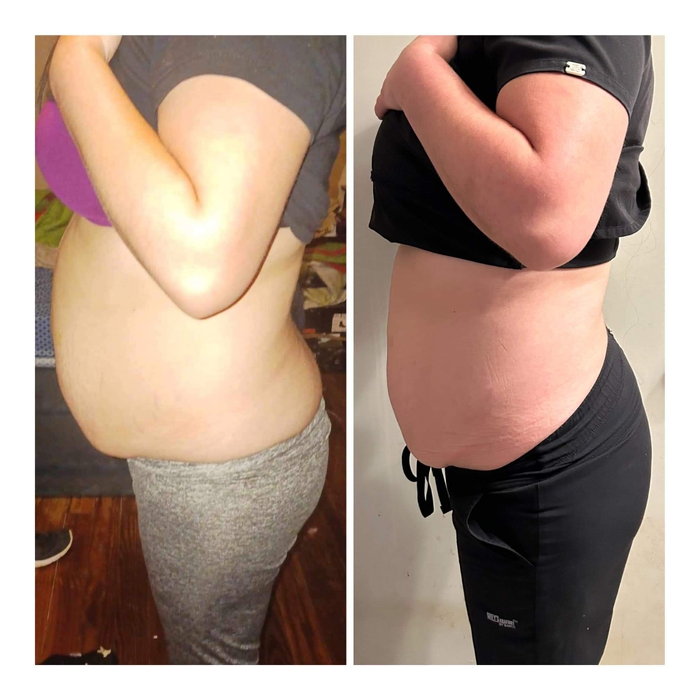 Topical Fat Dissolvers