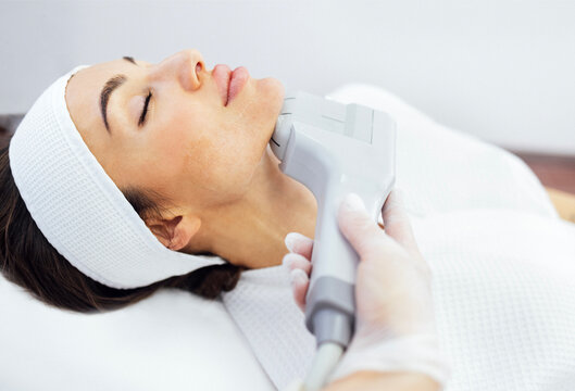 HIFU facelift