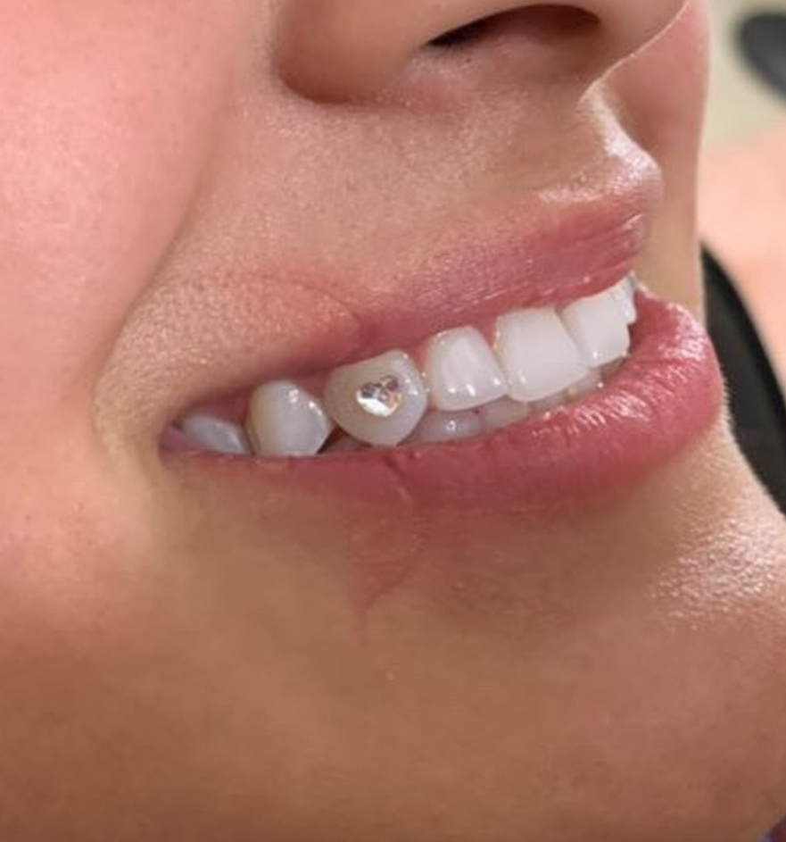 Teeth Gemz