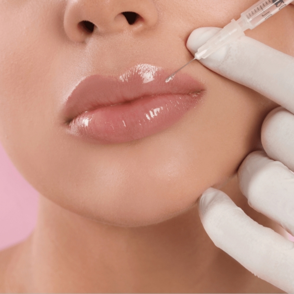Dermal Fillers at Wellness med spa in Palmview, TX
