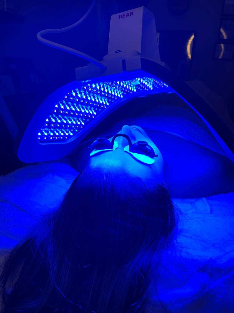 RedLight Therapy