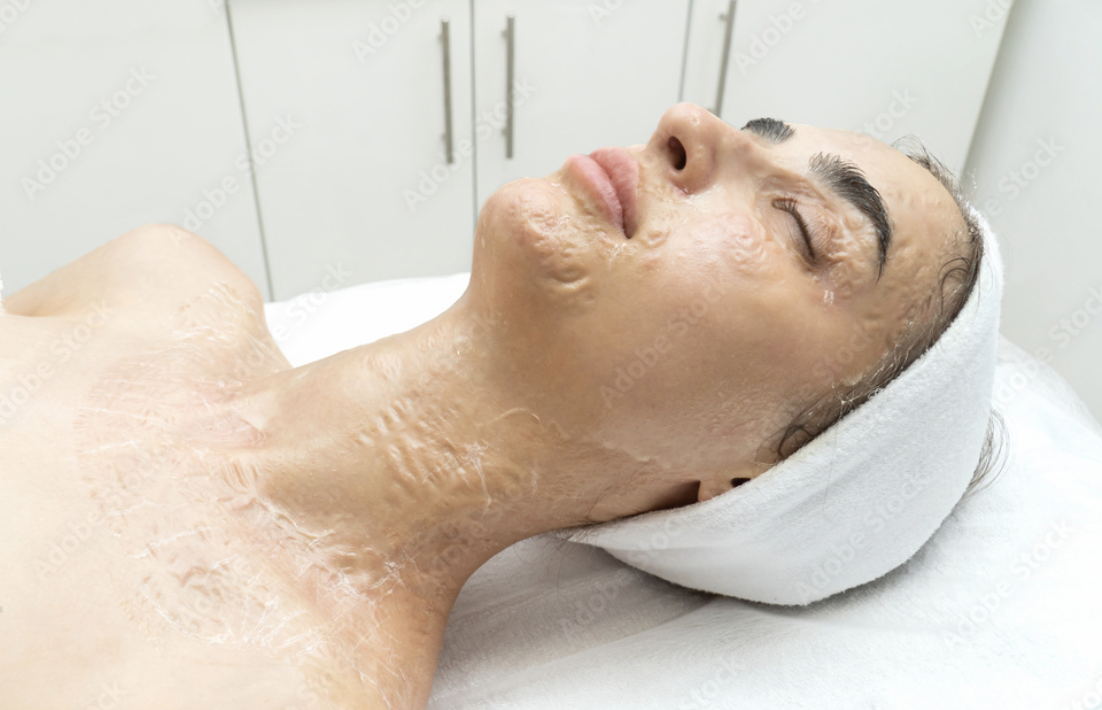 Enzyme Peel ADD-ON