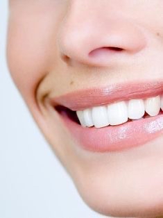 Teeth Whitening
