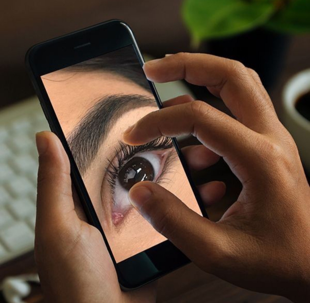 Brow Consult Call