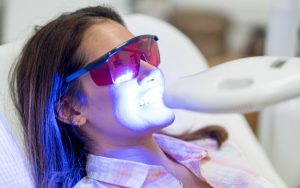 Hybrid Teeth Whitening (Reg. $225)