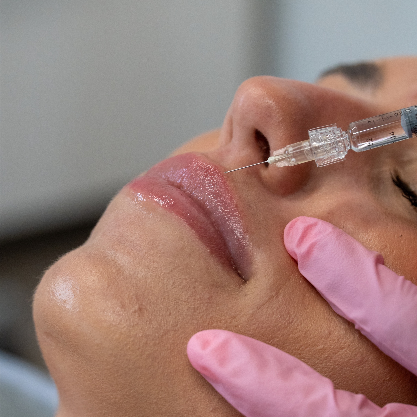 Signature Lips at Luxe Level Aesthetics in Darien, CT