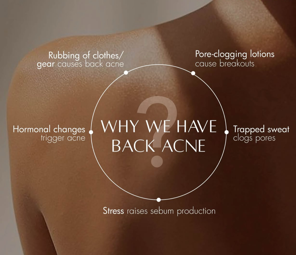 Back Treatment