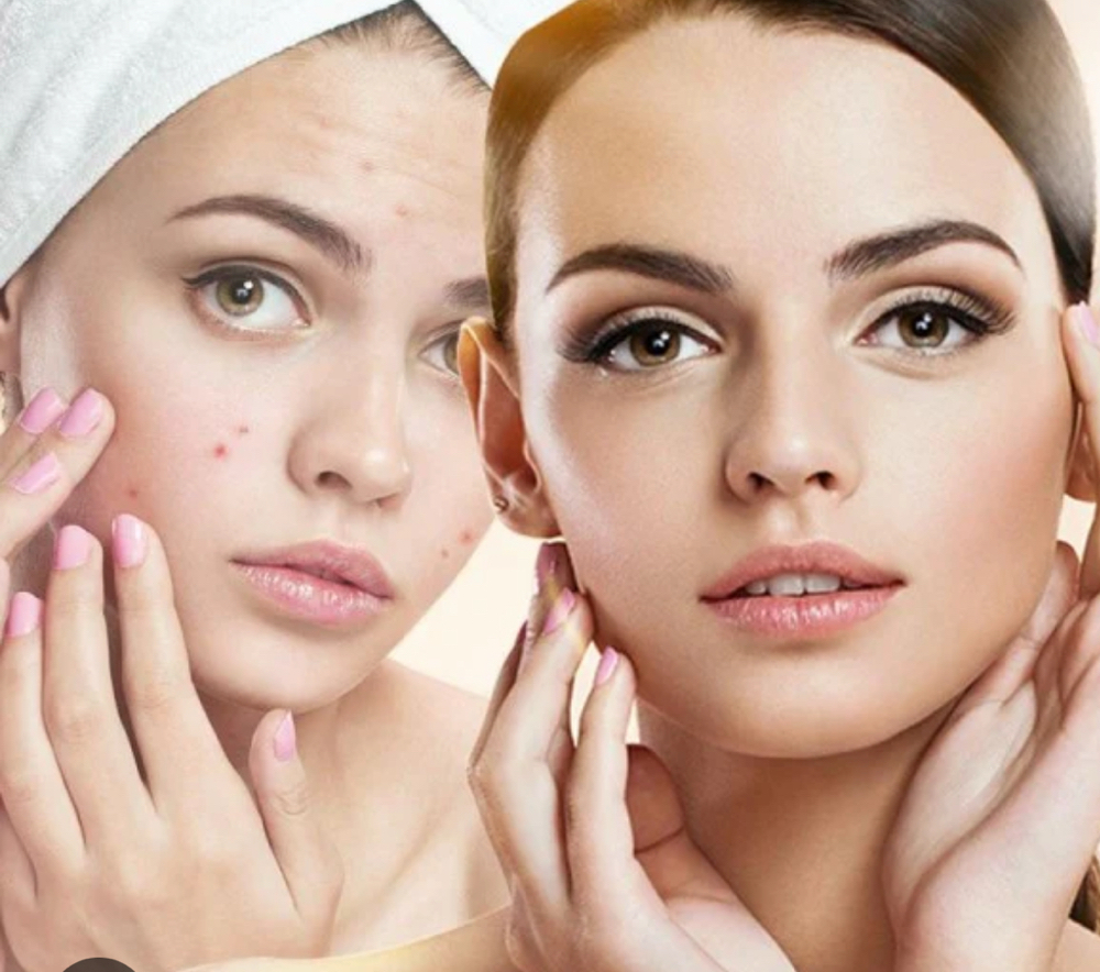 Clarifying Facial at Skin By Shelly in Port Washington, WI