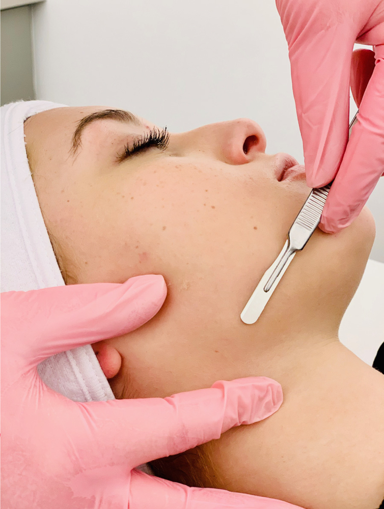 Dermaplane at Hair Headquarters in Harper, KS