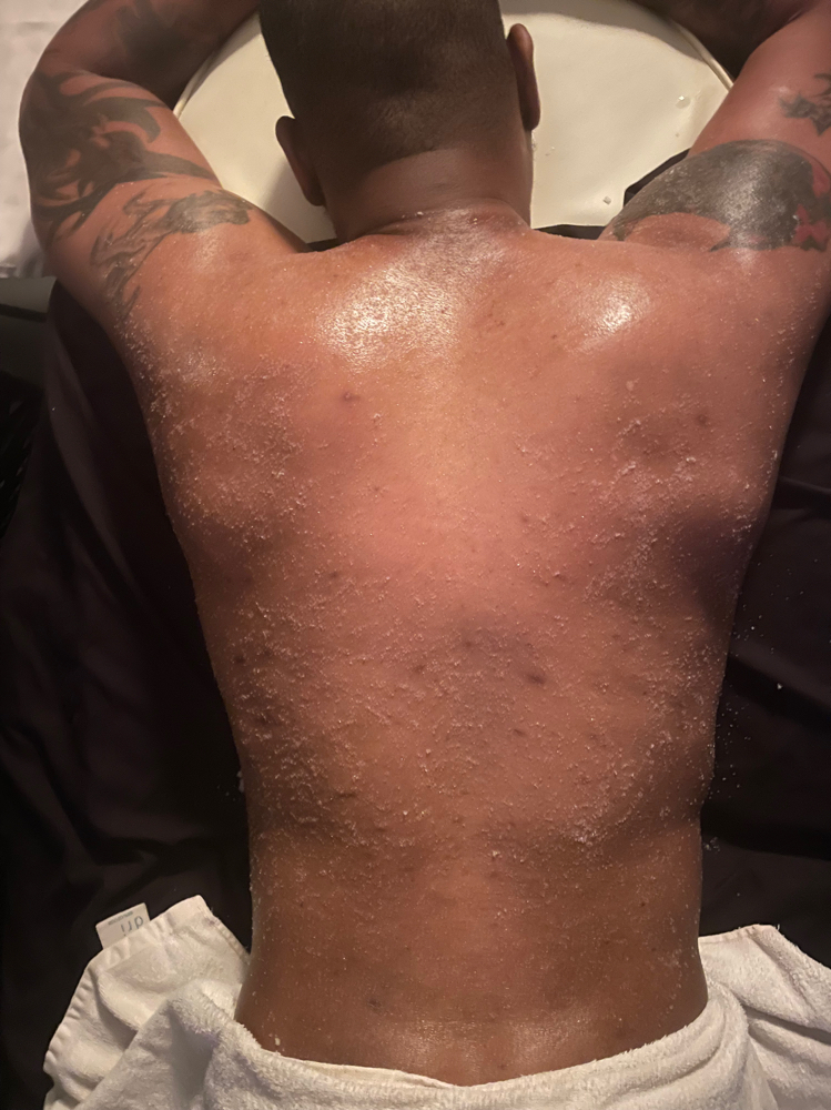 Detoxifying Back Facial at Tekila’s Timeless Touch in Flint, MI