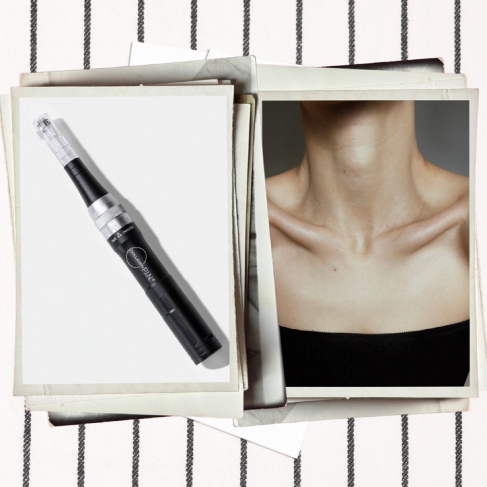 Add On Microneedling Neck at Alluring Soul in Joplin, MO