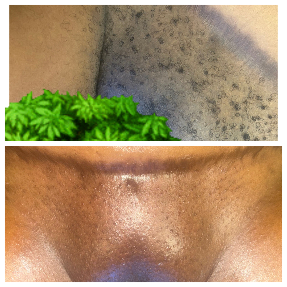 Brazilian Wax at Rhealm in Charlotte, NC