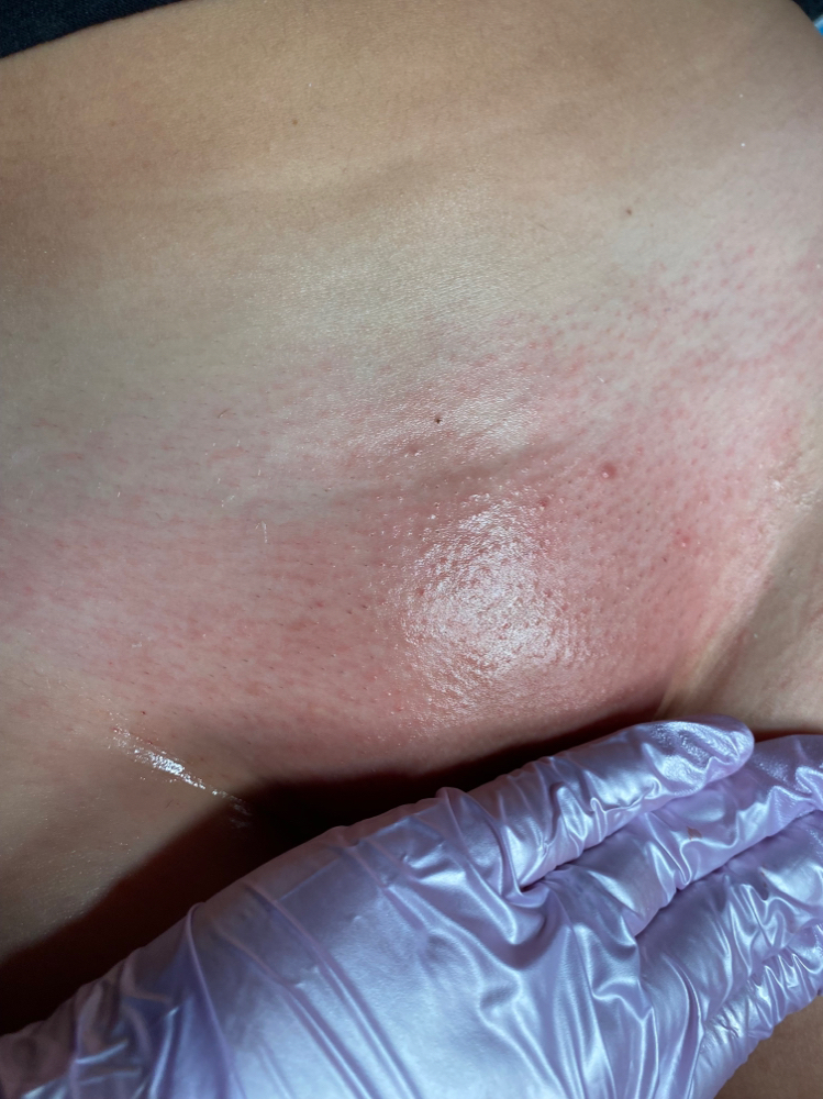 Extended Brazilian Wax
