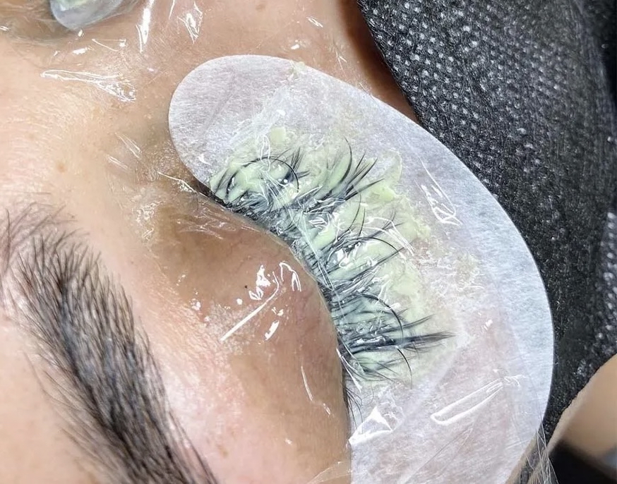 Eyelash Removal