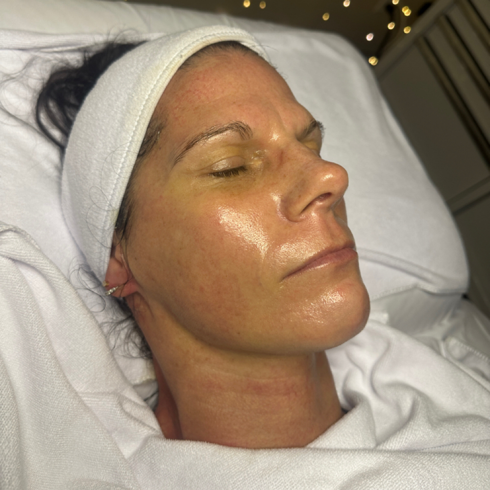 Firming Peptide + Oxygen RX