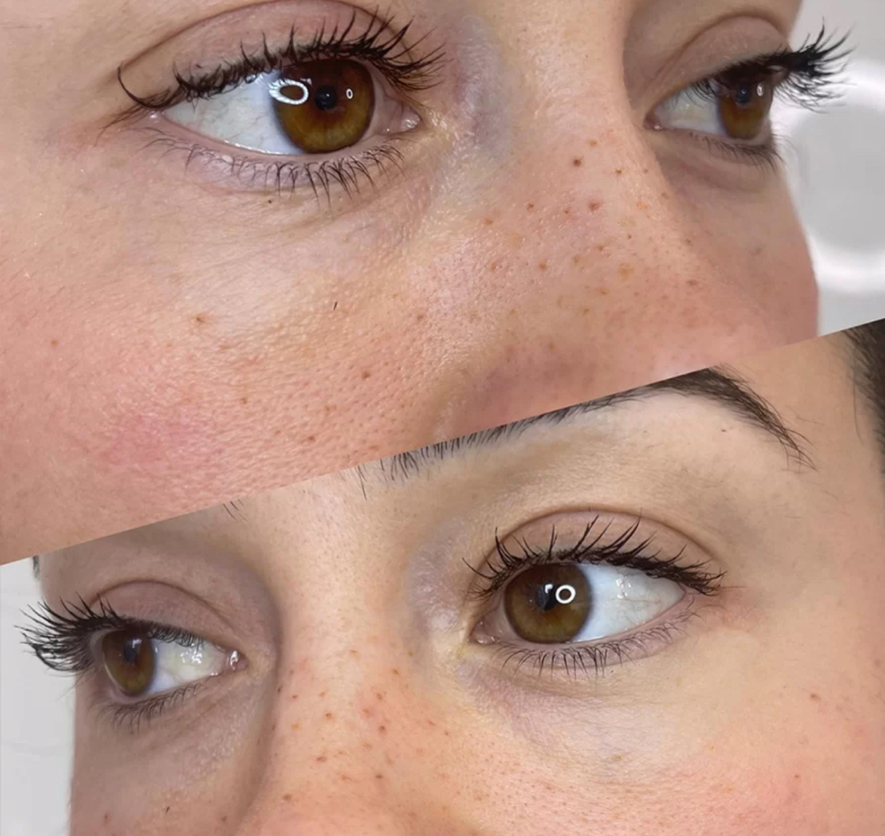 PMU Freckles