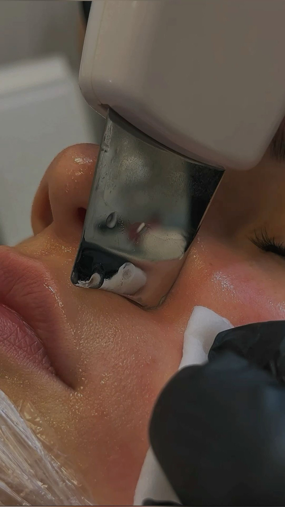 Facial Extractions