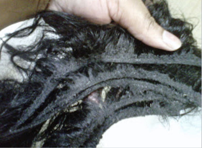 Sew- In / Quick Weave Removal