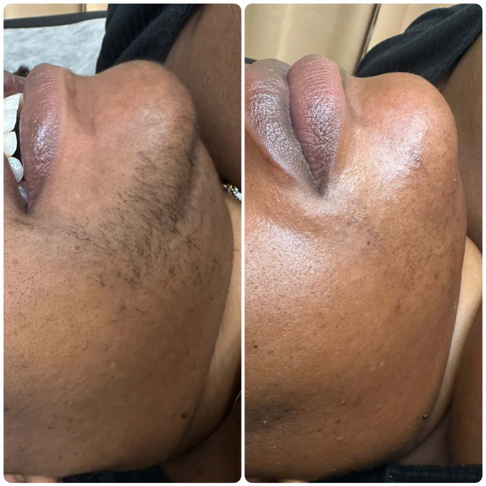 Chin + Neck Wax at Sacred Essence Aesthetics in Memphis, TN