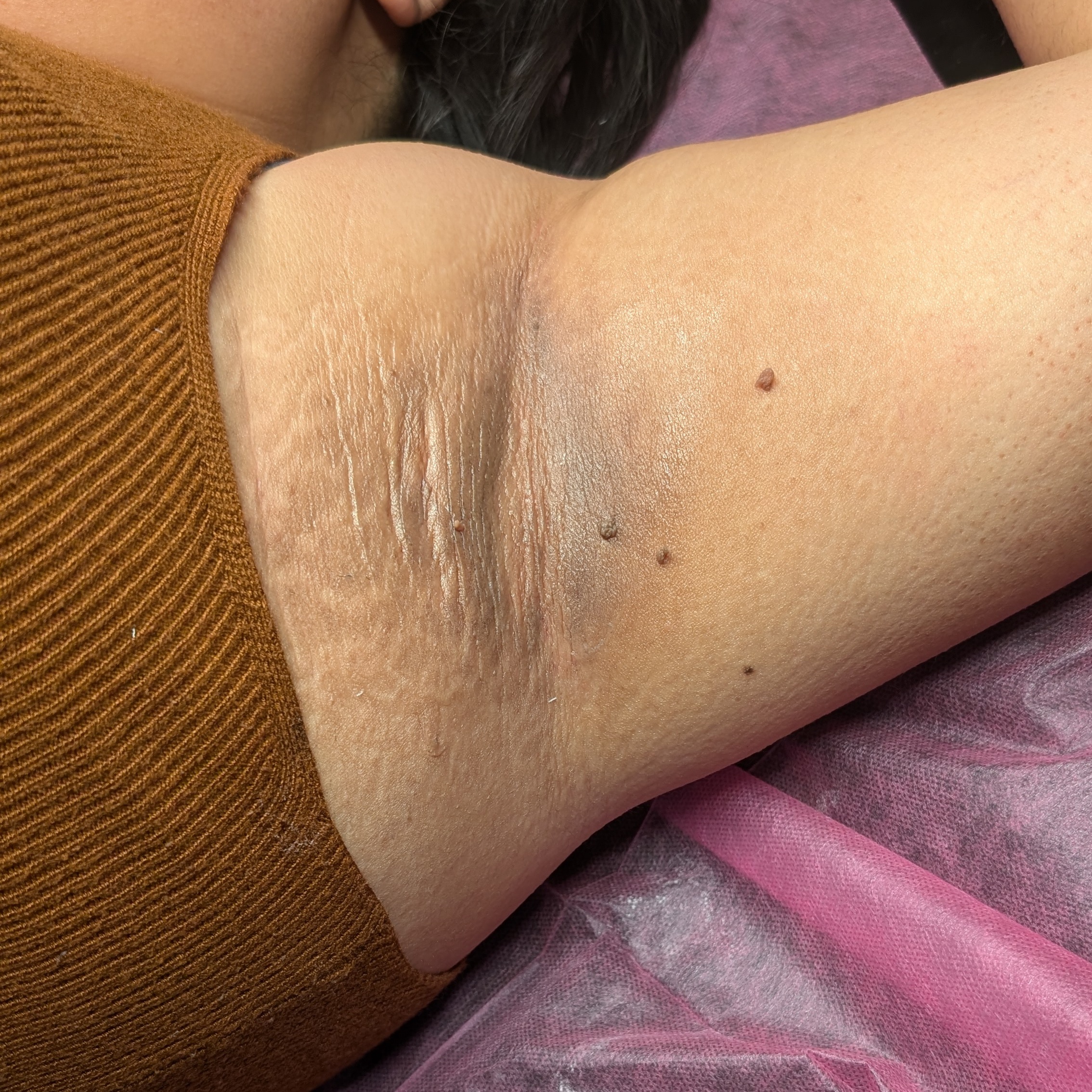 Underarm Wax at Skin by Kay in Orange, CA