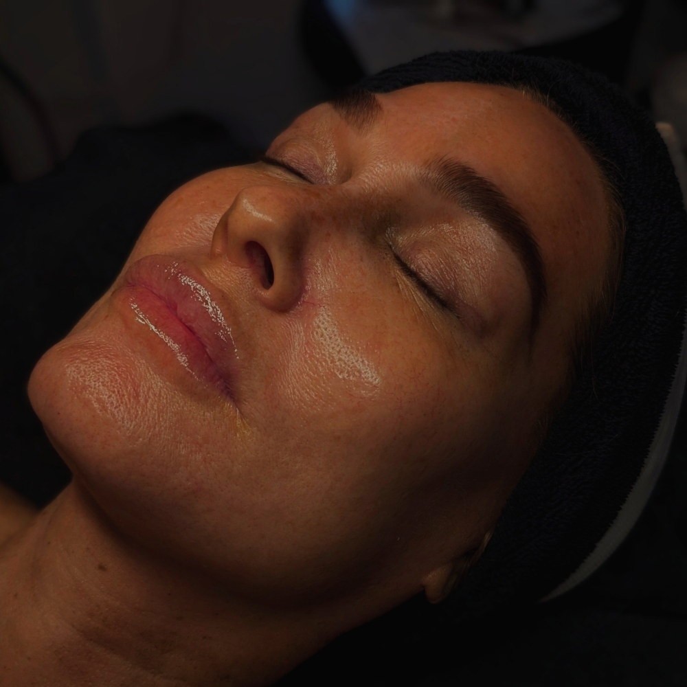 Sunshine Custom Facial w Dermaplane