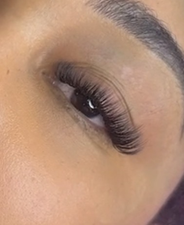 Hybrid Fill at Aesthetic Muse in Newington, CT