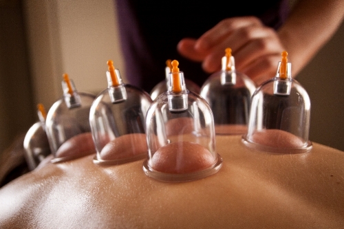 Cupping Add On