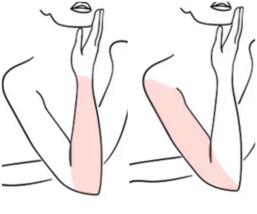 Half Arms