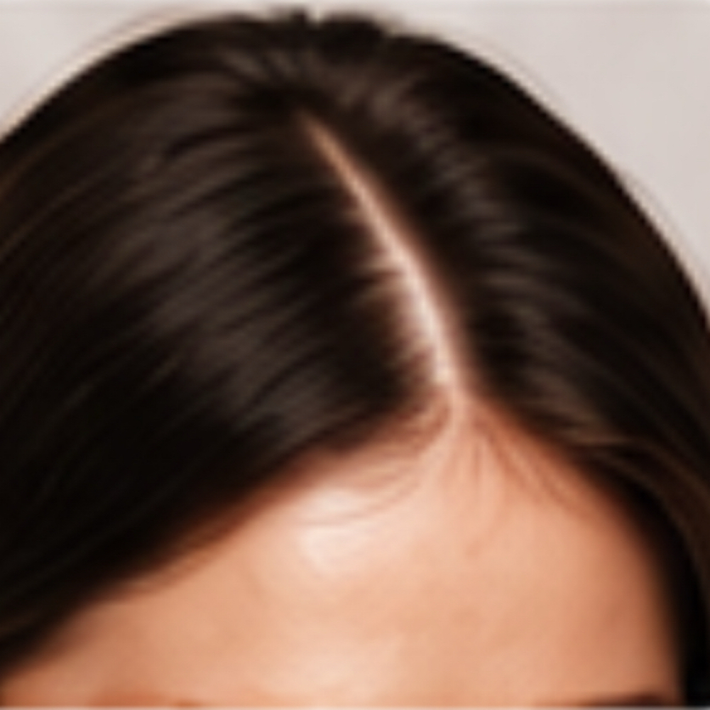 Fusion Plasma Hair & Scalp Regenera at Plasmalift Skin Clinic LLC in Bettendorf, IA