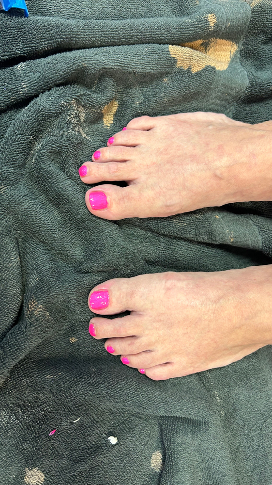 Gel Toes