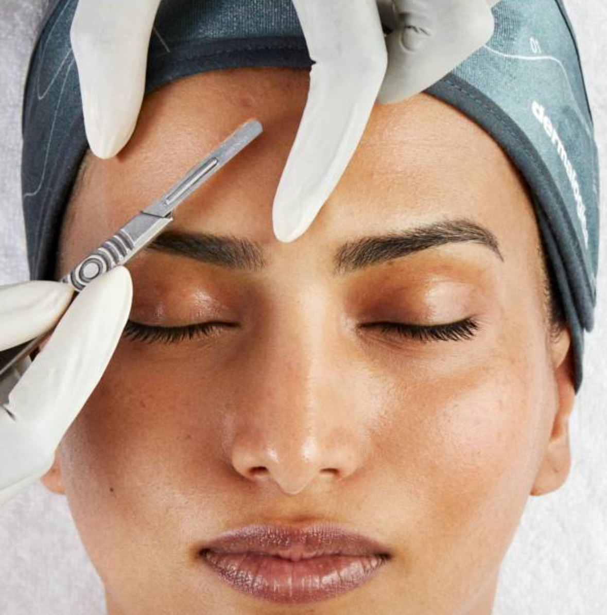 Dermaplaning at Le Reve in Fort worth, TX
