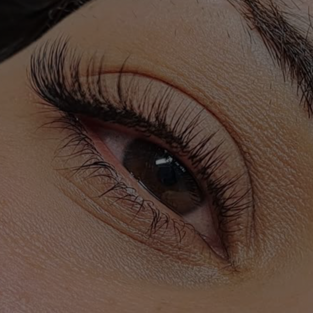 Classic 2wk Fill at Mirada Esthetics in Franklin, TN