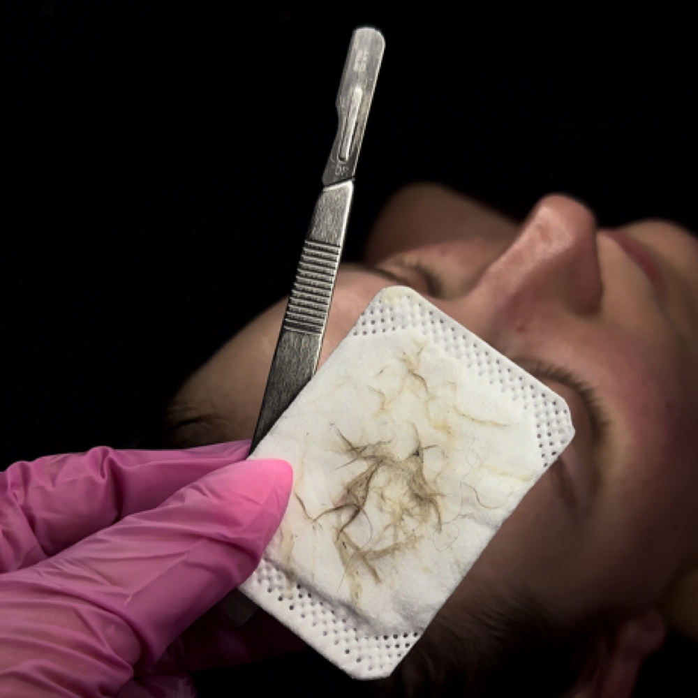 Dermaplaning at Just Peachy Beautie Bar in Sheboygan, WI