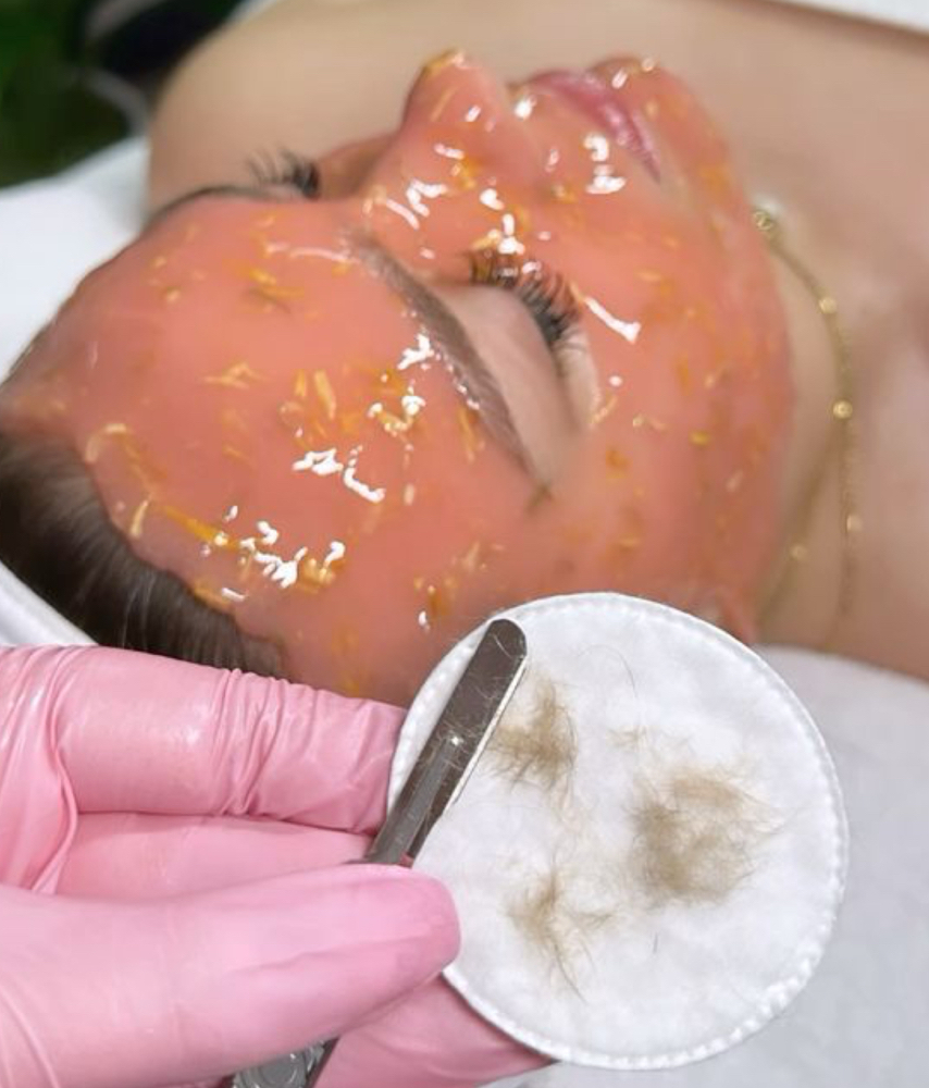 Dermaplaning Facial