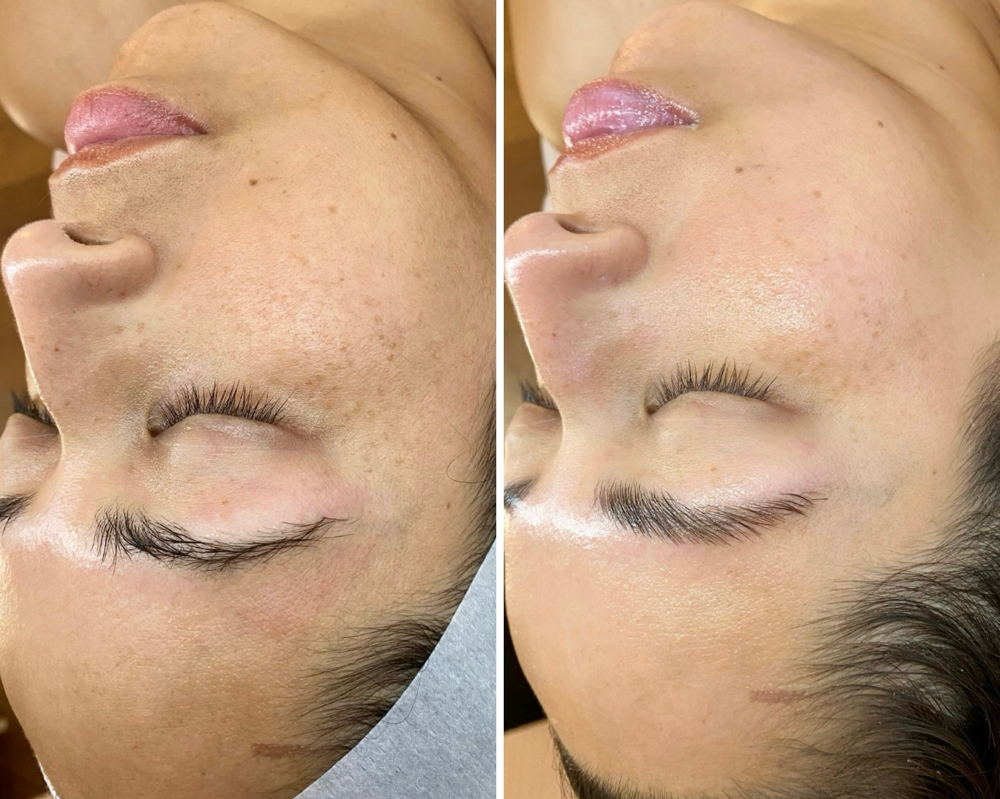 Advanced Skin Therapy