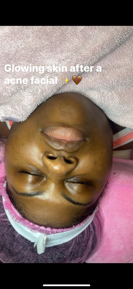 Express Facial
