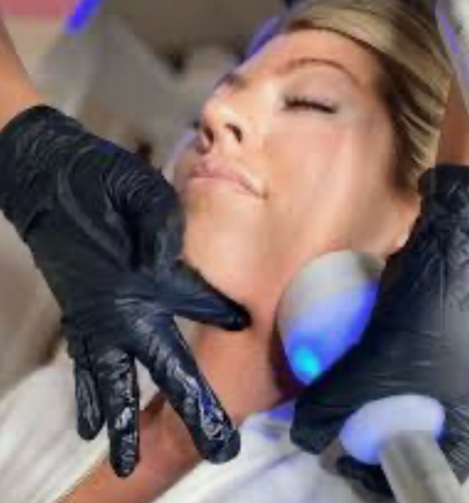 Cryoskin  Under Chin Slimming