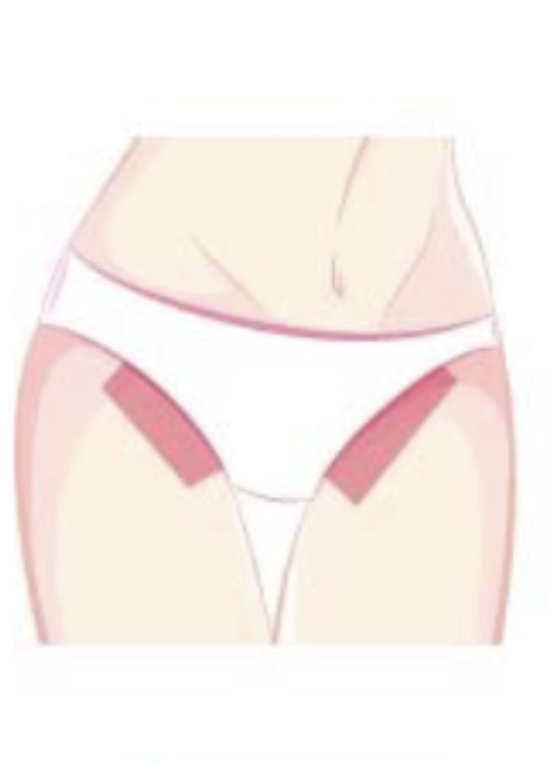 Bikini Line