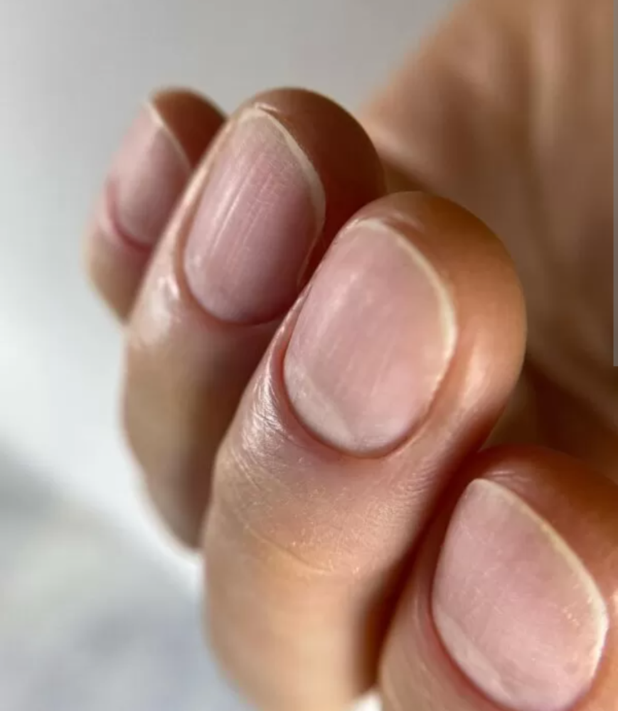 Hands