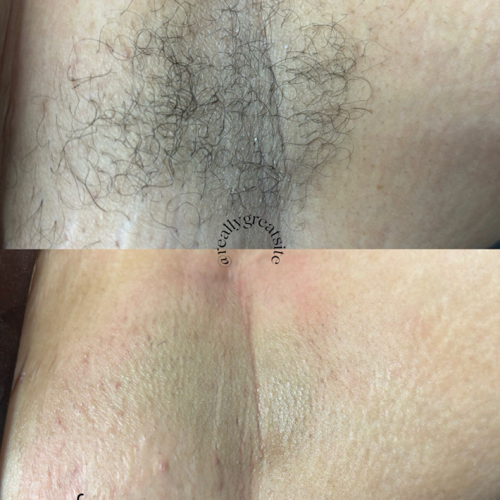 Underarms waxing at Blushin Beauty in Charlotte, NC