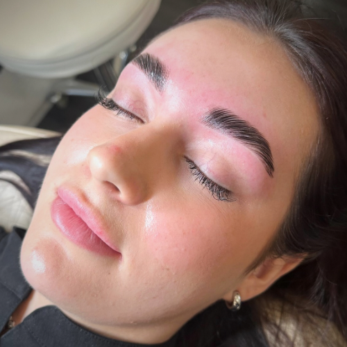 Dermaplane Add-on