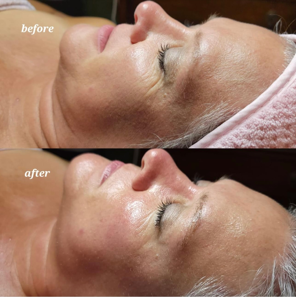 Luxe Lift Facial