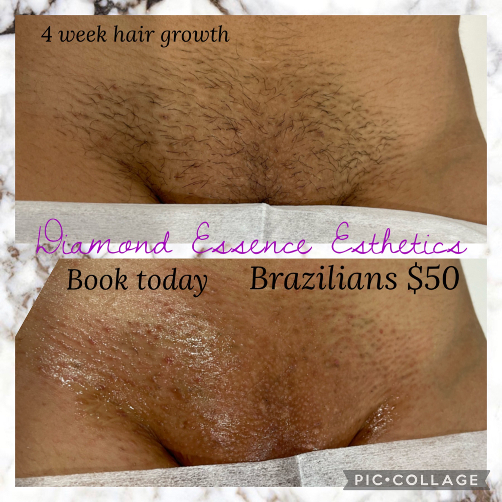 (V) Brazilian