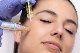 Microneedling