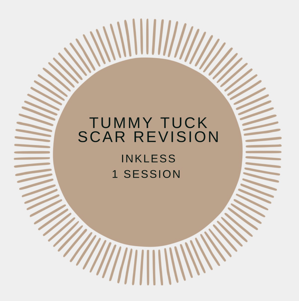 Tummy Tuck Scar Revision 1 Session